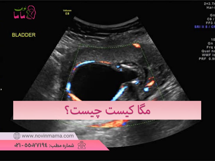 مگاکیست جنین چیست؟