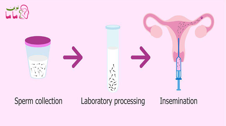 انتخاب جنسیت