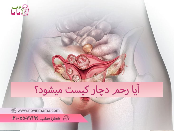 آیا رحم دچار کیست میشود؟
