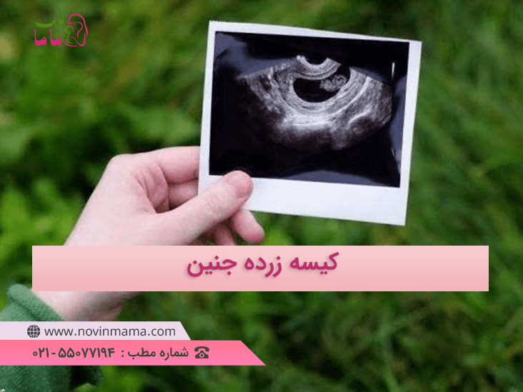 کیسه زرده چیست؟