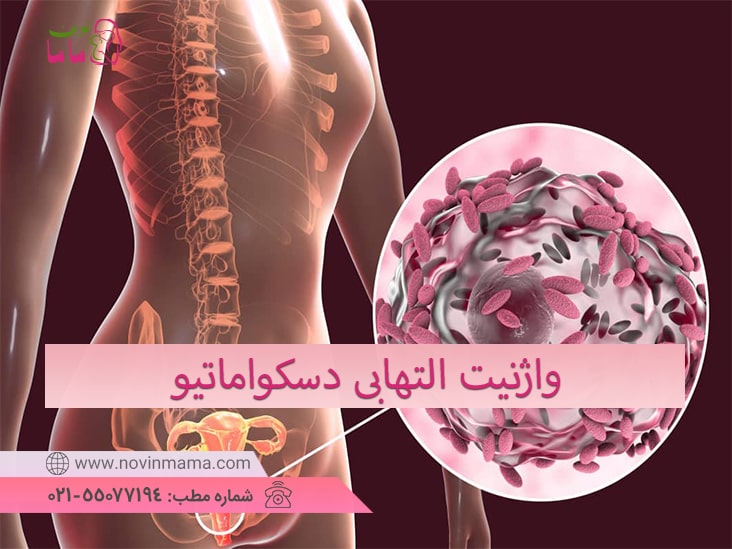 واژنیت التهابی دسکواماتیو