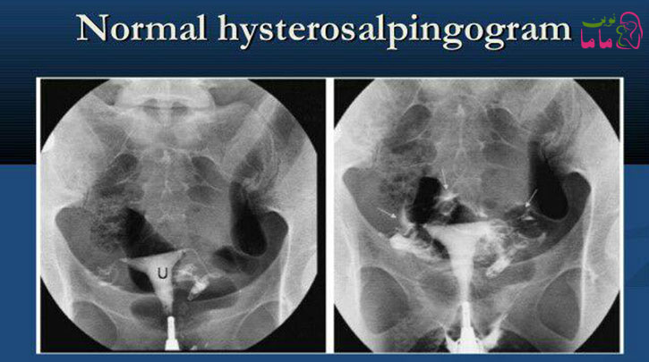 عکس رنگی از رحم