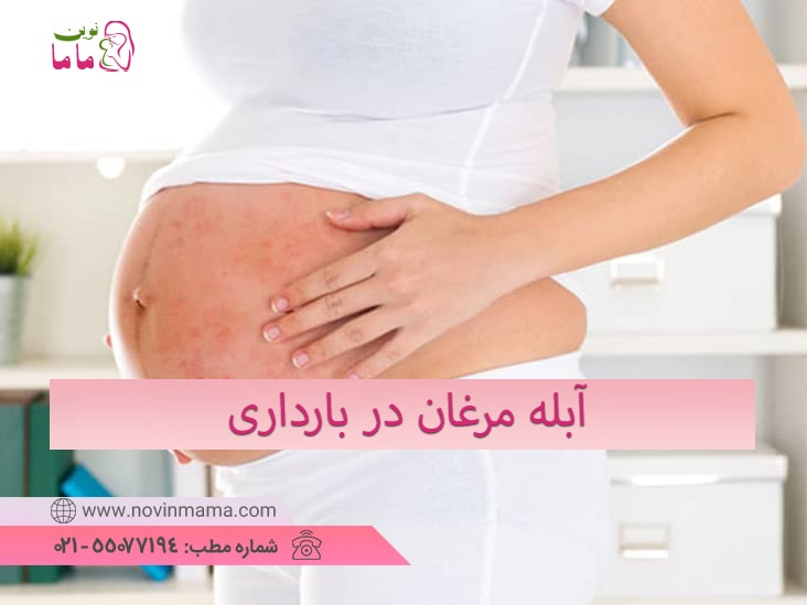 آبله مرغان در بارداری