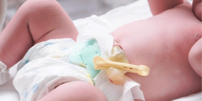 همه چیز در مورد بند ناف و نحوه مراقبت از آن؛ هر آنچه مادران باید بدانند