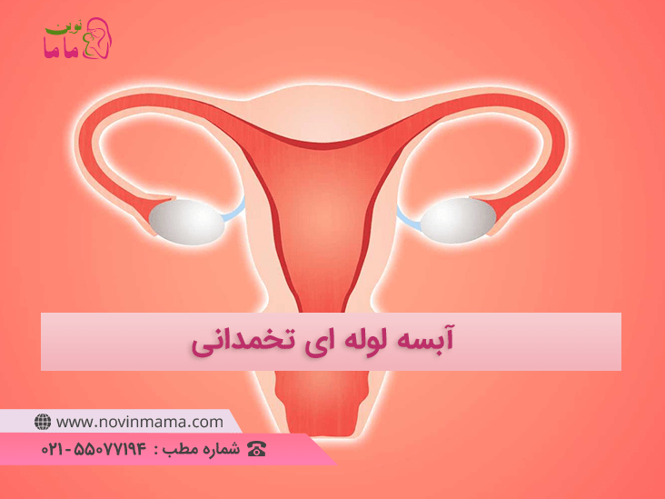 آبسه تخمدانی چیست ؟ 