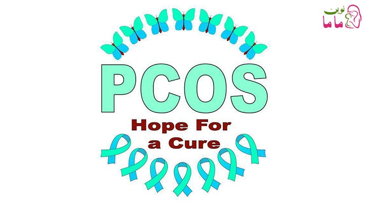 ارتباط بین کیست تخمدان و ناباروری