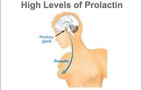آزمایش پرولاکتین چگونه انجام می‌شود؟‎