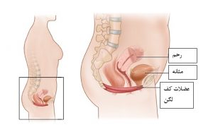 اسپاسم عضله کف لگن
